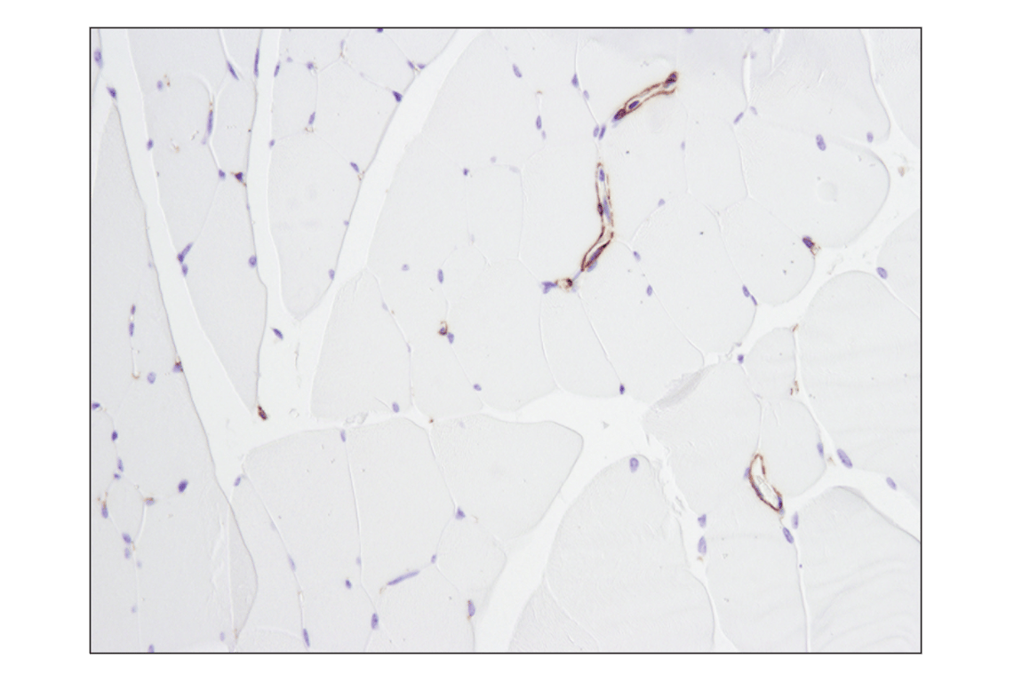 Immunohistochemistry Image 7: alpha-Smooth Muscle Actin (D4K9N) Rabbit Monoclonal Antibody (BSA and Azide Free)