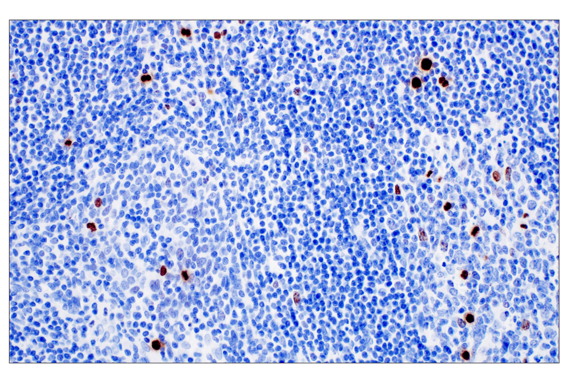 Immunohistochemistry Image 4: Phospho-Histone H3 (Ser10) (D7N8E) Rabbit Monoclonal Antibody