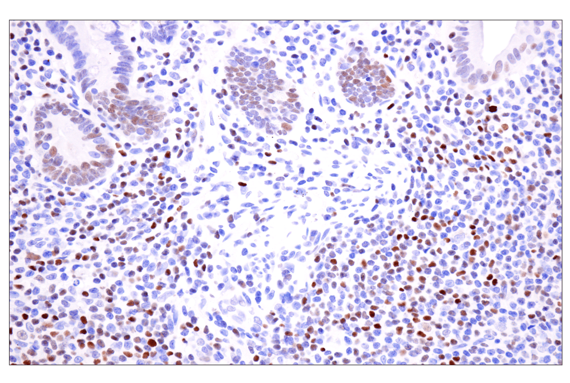 Immunohistochemistry Image 6: TCF1/TCF7 (E6O1K) Rabbit Monoclonal Antibody