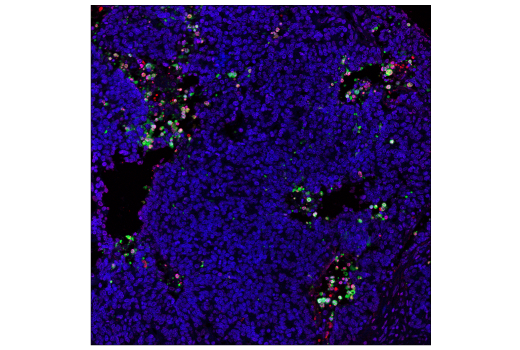 Immunohistochemistry Image 1: TUNEL Assay Kit (Fluorescence, 640 nm)