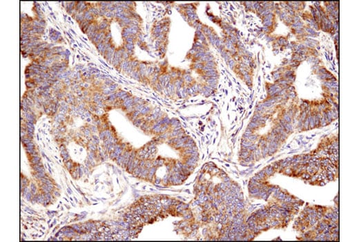 Immunohistochemistry Image 2: Bak (D4E4) Rabbit Monoclonal Antibody (BSA and Azide Free)