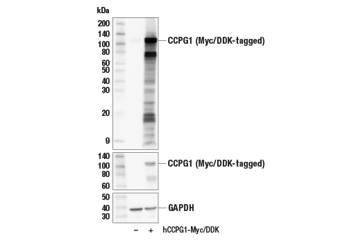 undefined Image 14: ER Homeostasis Antibody Sampler Kit