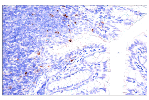 Immunohistochemistry Image 8: CTLA-4 (E2V1Z) Rabbit mAb (BSA and Azide Free)