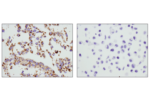 Immunohistochemistry Image 1: COX IV (D6I4K) Rabbit Monoclonal Antibody