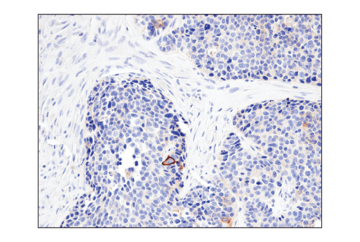 Immunohistochemistry Image 2: CD47 (D3O7P) Rabbit Monoclonal Antibody