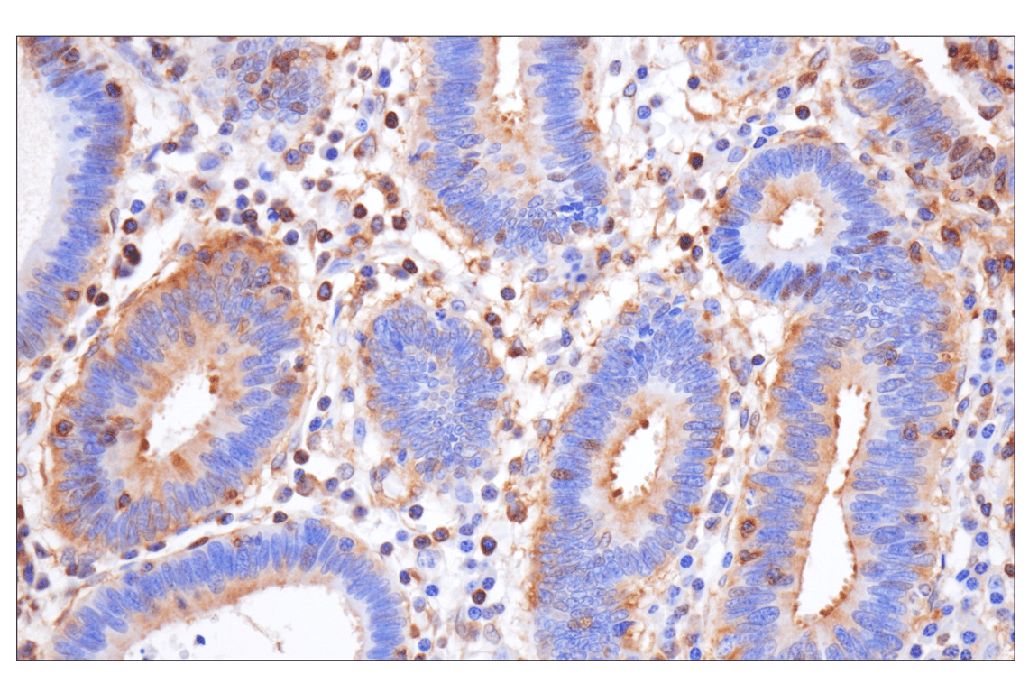 Immunohistochemistry Image 2: NF-kappaB p65 (D14E12) Rabbit Monoclonal Antibody (BSA and Azide Free)