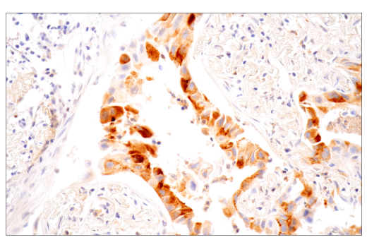 Immunohistochemistry Image 5: MMP-1 (E9S9N) Rabbit Monoclonal Antibody