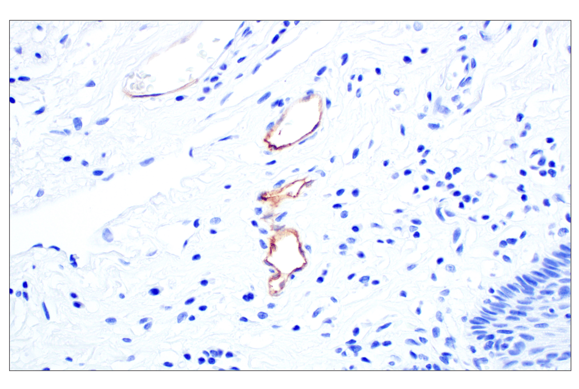 Immunohistochemistry Image 4: MAdCAM-1 (E1V8F) Rabbit Monoclonal Antibody (BSA and Azide Free)