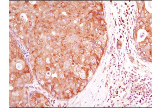 Immunohistochemistry Image 1: HDAC6 (D2E5) Rabbit Monoclonal Antibody