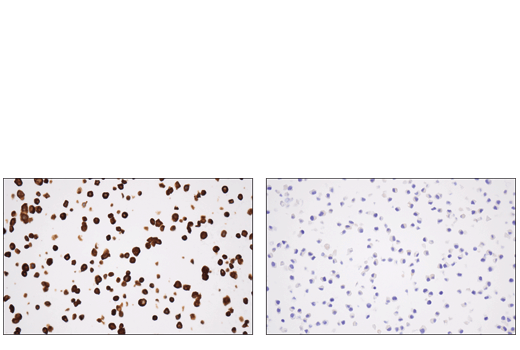 Immunohistochemistry Image 2: Tyrosine Hydroxylase (E2L6M) Rabbit Monoclonal Antibody (BSA and Azide Free)
