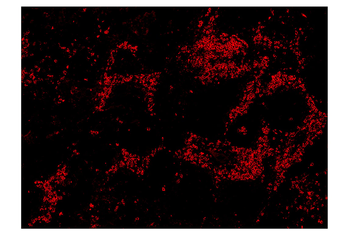 Immunohistochemistry Image 4: CD20 (E7B7T) & CO-0011-594 SignalStar<sup>™</sup> Oligo-Antibody Pair