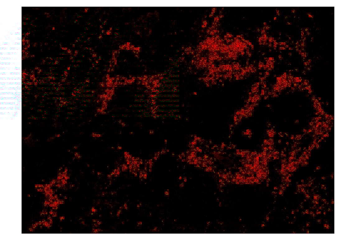 Immunohistochemistry Image 4: CD20 (E7B7T) & CO-0011-488 SignalStar<sup>™</sup> Oligo-Antibody Pair