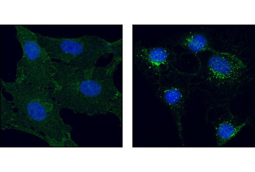 undefined Image 26: Angiogenesis Receptor Tyrosine Kinase Antibody Sampler Kit