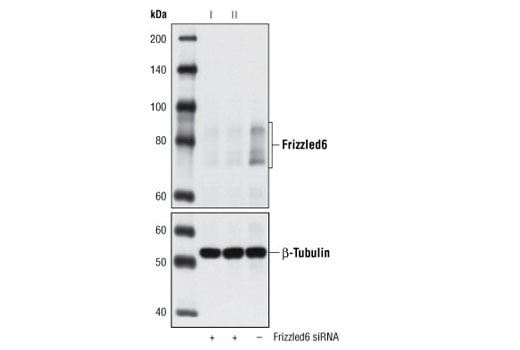 Western Blotting Image 2: Frizzled6 (D16E5) Rabbit Monoclonal Antibody