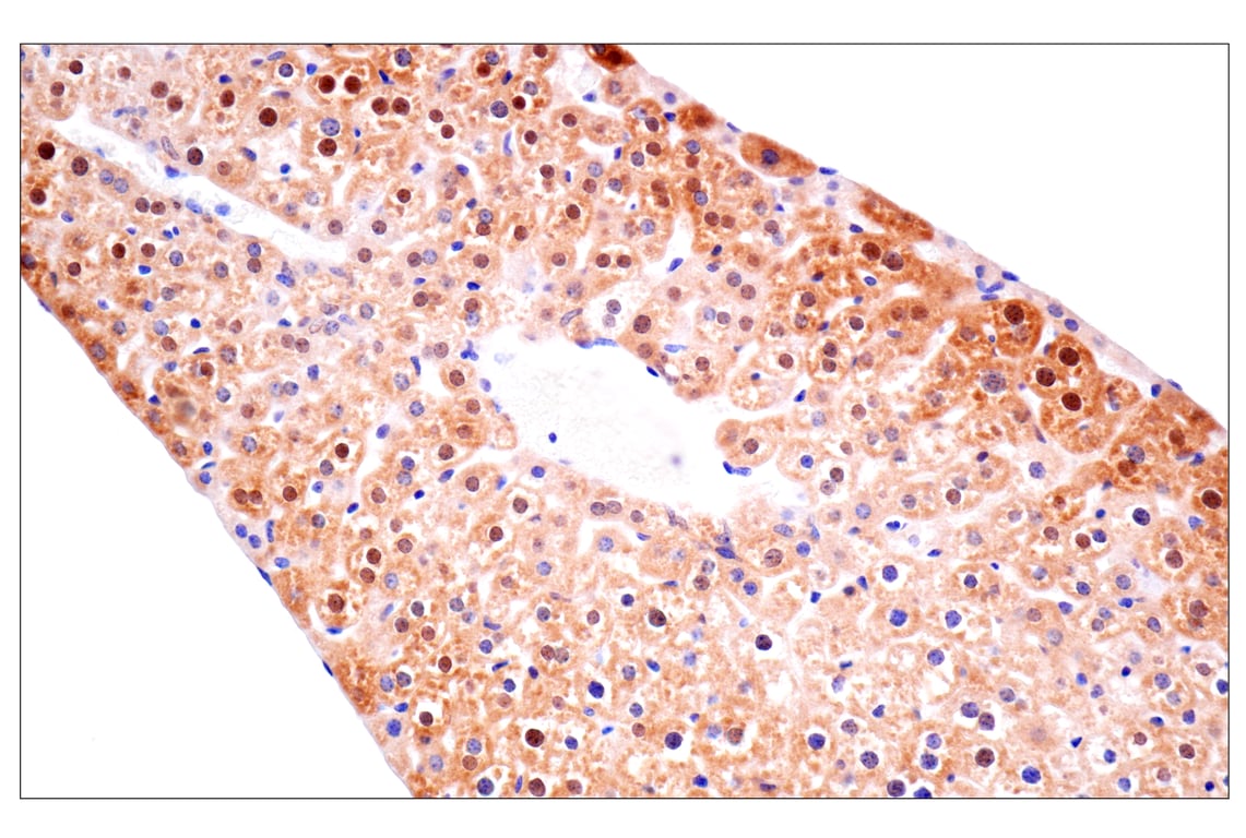 Immunohistochemistry Image 12: ACBP/DBI (E4V8V) Rabbit Monoclonal Antibody