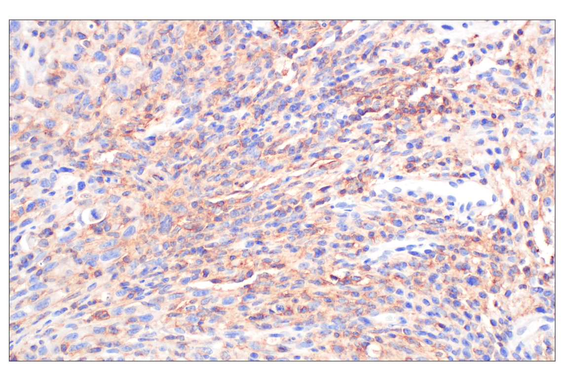 Immunohistochemistry Image 2: CCL3/MIP-1 alpha (F2M8Q) Rabbit Monoclonal Antibody