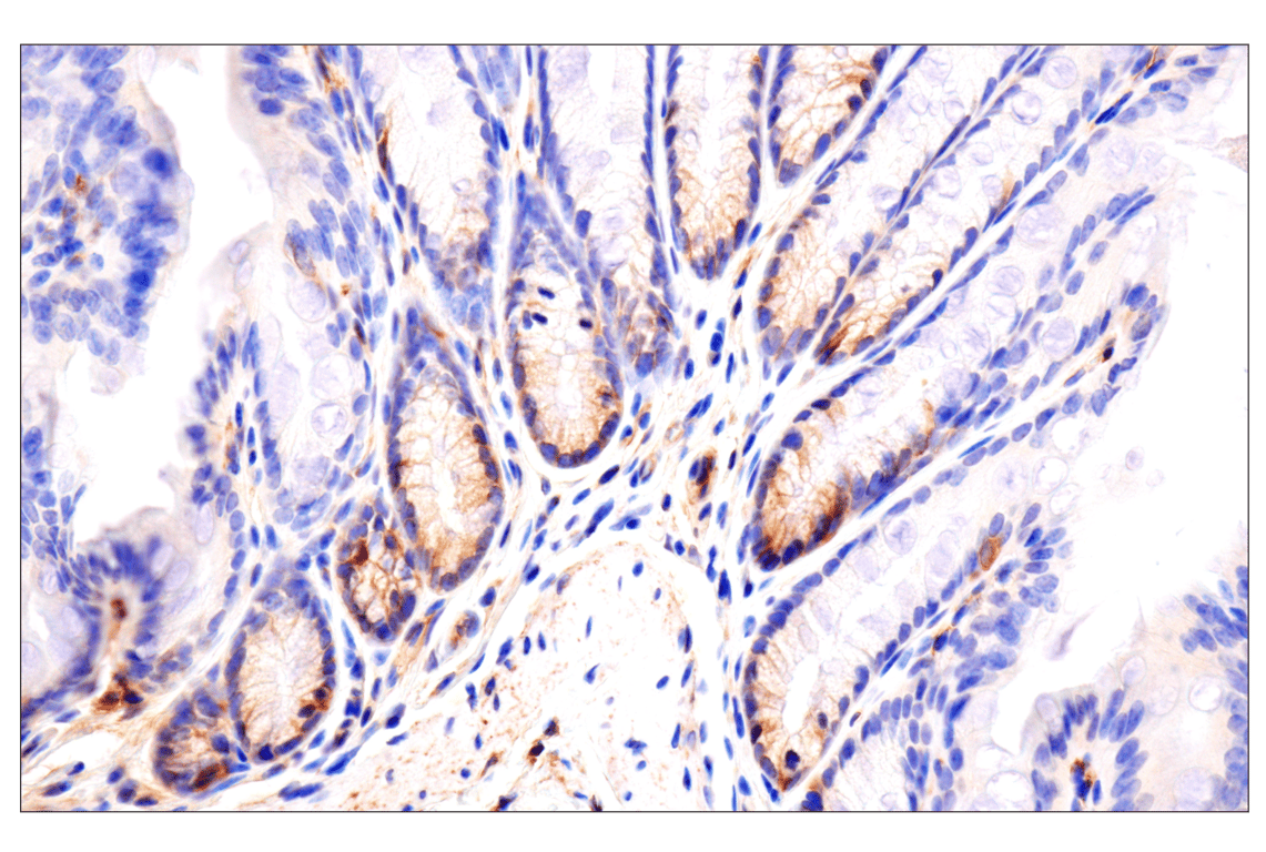 Immunohistochemistry Image 7: CD81 (D5O2Q) Rabbit Monoclonal Antibody