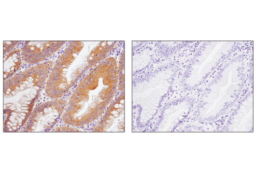 undefined Image 17: AMPK Substrate Antibody Sampler Kit