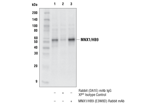 Immunoprecipitation Image 1: MNX1/HB9 (E3W8D) Rabbit Monoclonal Antibody