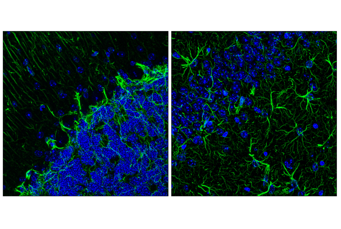 Immunofluorescence Image 1: GFAP (E4L7M) Rabbit Monoclonal Antibody