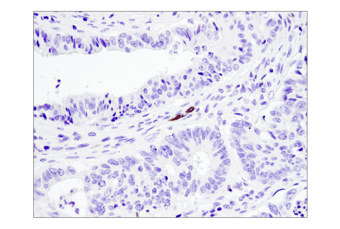 Immunohistochemistry Image 3: TNFRSF8/CD30 (E4L4I) Rabbit Monoclonal Antibody (BSA and Azide Free)