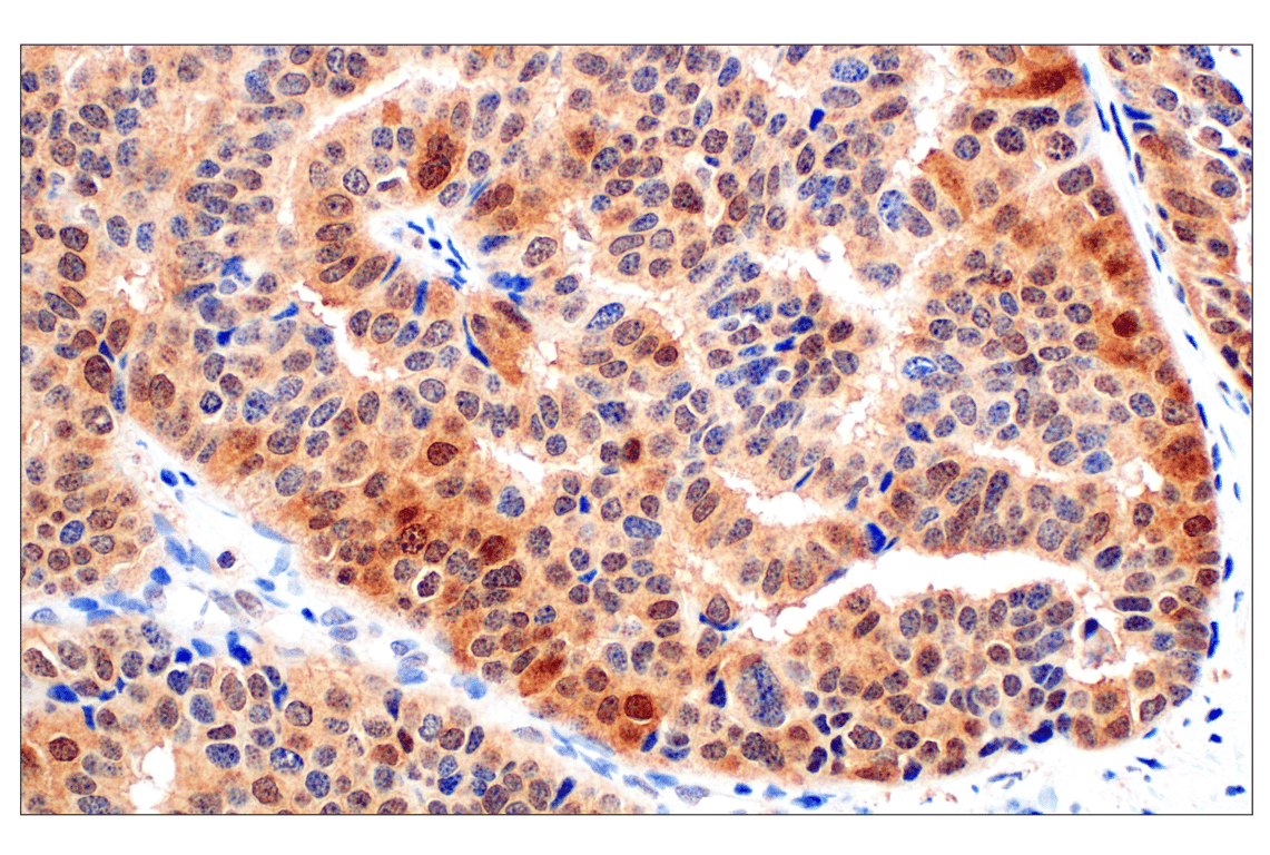 Immunohistochemistry Image 4: Stat3 (124H6) Mouse Monoclonal Antibody (BSA and Azide Free)