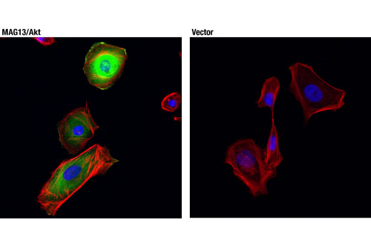 Immunofluorescence Image 1: MAGI3-Akt3 Fusion Protein (D4D3P) Rabbit Monoclonal Antibody