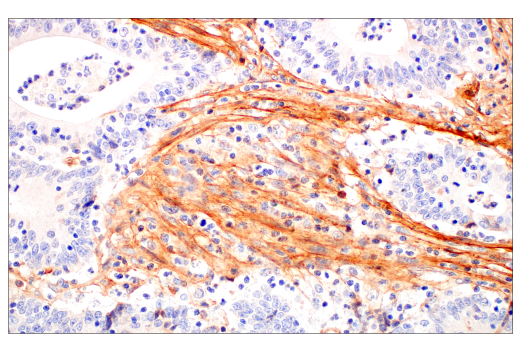 Immunohistochemistry Image 5: Periostin (E5F2S) Rabbit Monoclonal Antibody