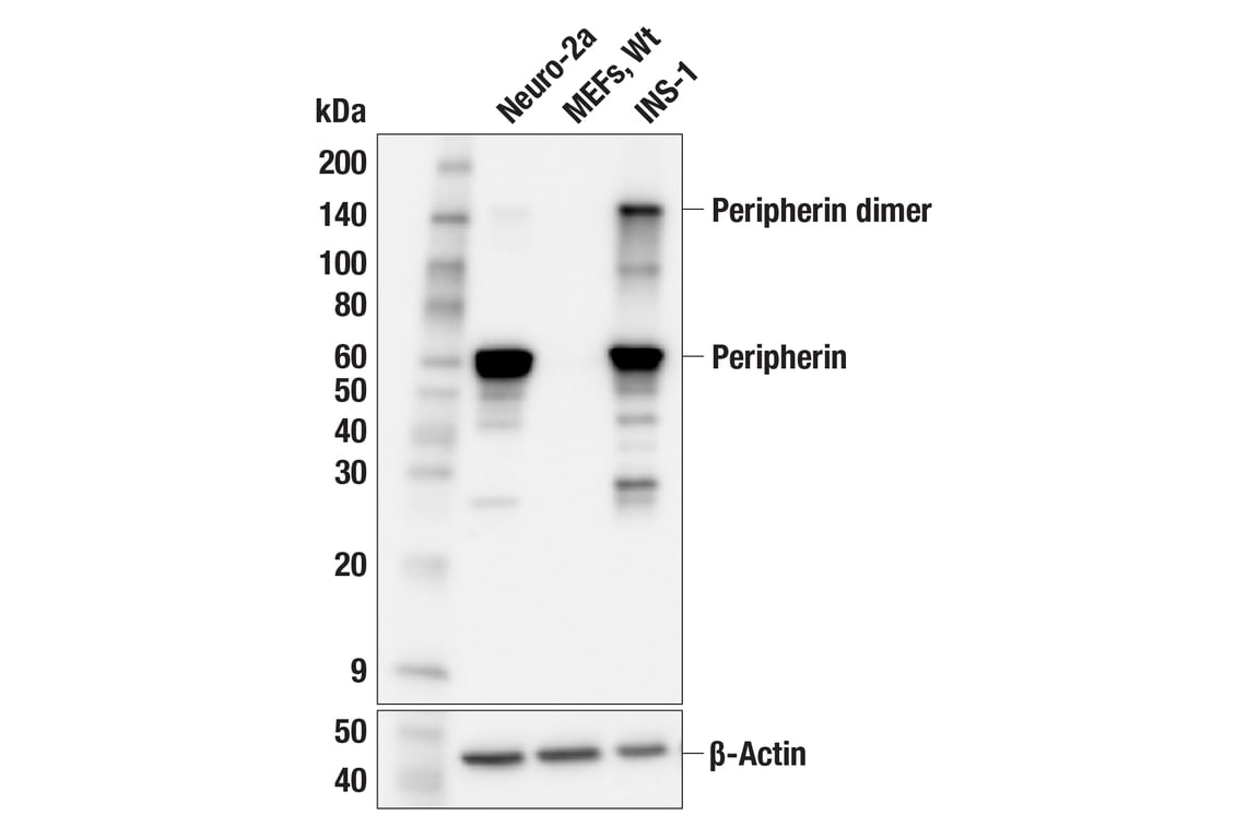 Western Blotting Image 2: Peripherin (F3J1R) Rabbit Monoclonal Antibody