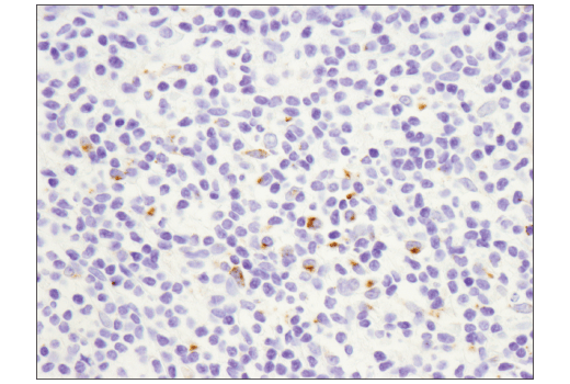 Immunohistochemistry Image 4: OX40L (D6K7R) Rabbit Monoclonal Antibody