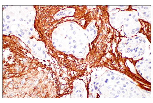Immunohistochemistry Image 4: COL3A1 (E8D7R) Rabbit Monoclonal Antibody (BSA and Azide Free)
