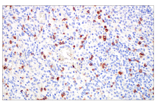 Immunohistochemistry Image 2: TRDC/TCR delta (E2E9T) Rabbit Monoclonal Antibody (BSA and Azide Free)