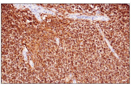 Immunohistochemistry Image 4: CD48 (D7L8I) Rabbit Monoclonal Antibody