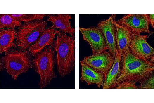 Immunofluorescence Image 2: Acetyl-alpha-Tubulin (Lys40) (D20G3) Rabbit Monoclonal Antibody