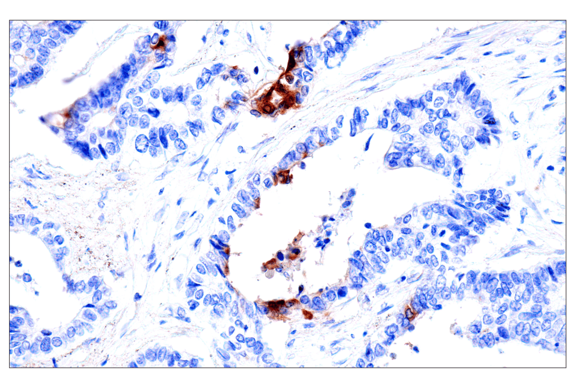 Immunohistochemistry Image 6: CEACAM7 (E5Q6X) Rabbit Monoclonal Antibody