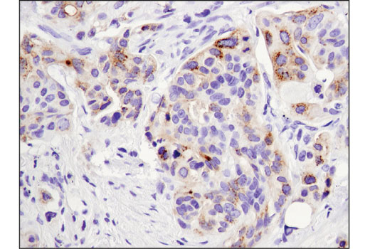 Immunohistochemistry Image 1: FGF19 (D1N3R) Rabbit Monoclonal Antibody