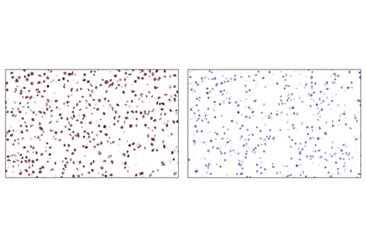 undefined Image 55: Epithelial-Mesenchymal Transition (EMT) IF Antibody Sampler Kit