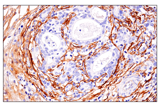 Immunohistochemistry Image 1: CD248 (E9Z7O) Rabbit Monoclonal Antibody (BSA and Azide Free)