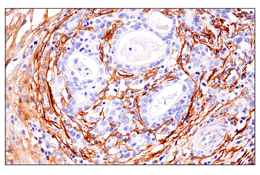 Immunohistochemistry Image 1: CD248 (E9Z7O) XP<sup>®</sup> Rabbit mAb (BSA and Azide Free)