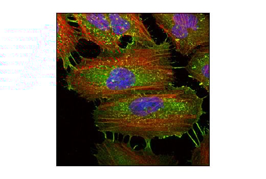 Immunofluorescence Image 1: Ezrin Antibody