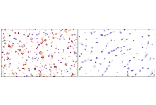 Immunohistochemistry Image 11: PLVAP (E3X9D) Rabbit Monoclonal Antibody