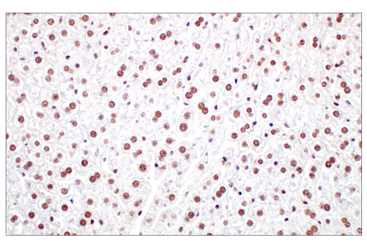 Immunohistochemistry Image 6: Ezh2 (D2C9) Rabbit Monoclonal Antibody (BSA and Azide Free)