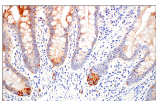 Immunohistochemistry Image 8: LCN2 (D4M8L) Rabbit Monoclonal Antibody
