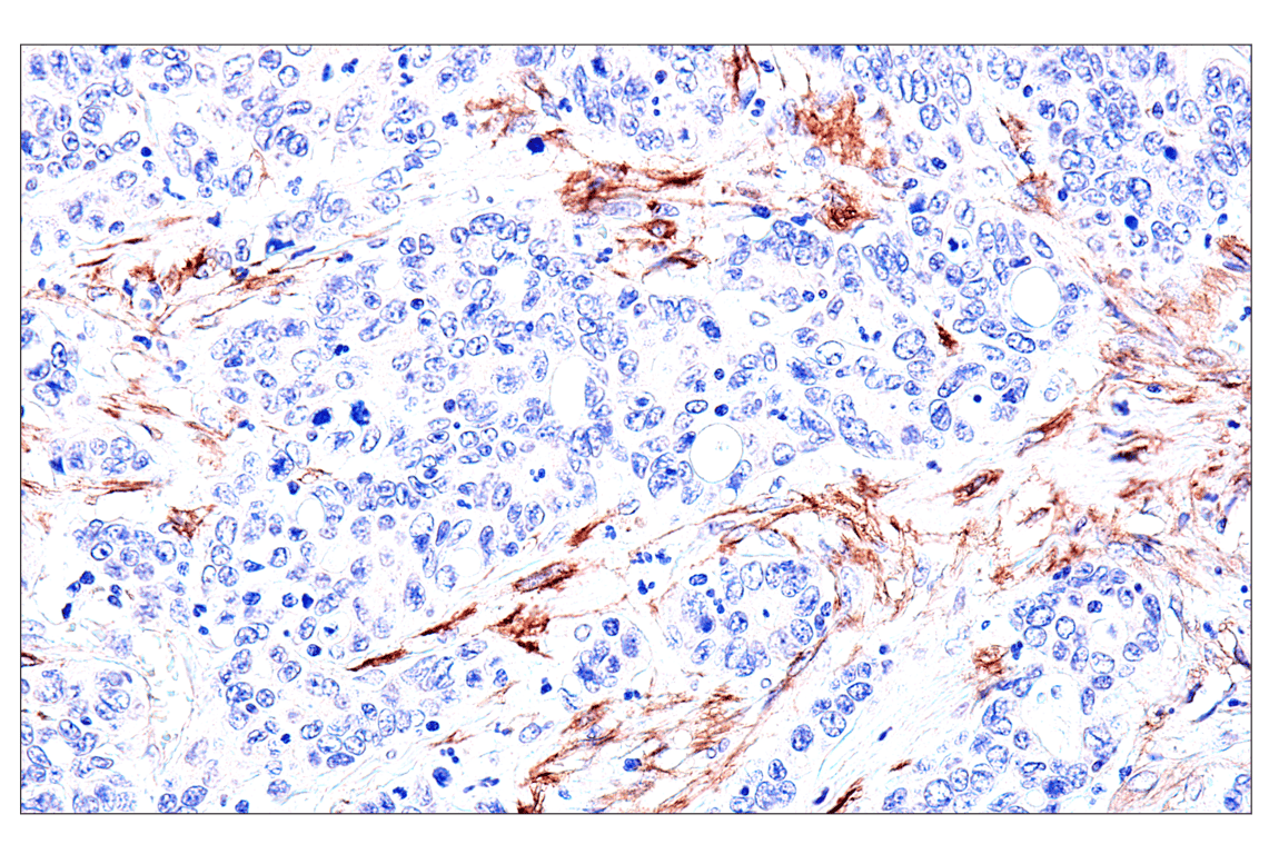 Immunohistochemistry Image 8: FAP (F1A4G) Rabbit Monoclonal Antibody