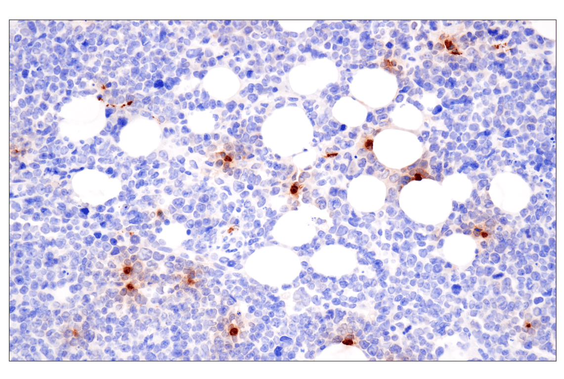 Immunohistochemistry Image 1: Eosinophil cationic protein (F3G7N) Rabbit Monoclonal Antibody