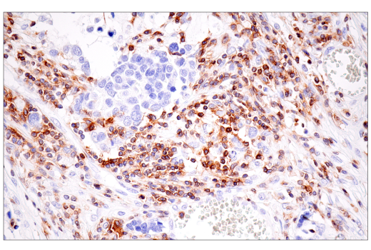 Immunohistochemistry Image 8: SLAMF6/CD352 (E3H1E) Rabbit Monoclonal Antibody (BSA and Azide Free)
