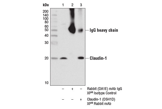 undefined Image 16: Epithelial-Mesenchymal Transition (EMT) Antibody Sampler Kit