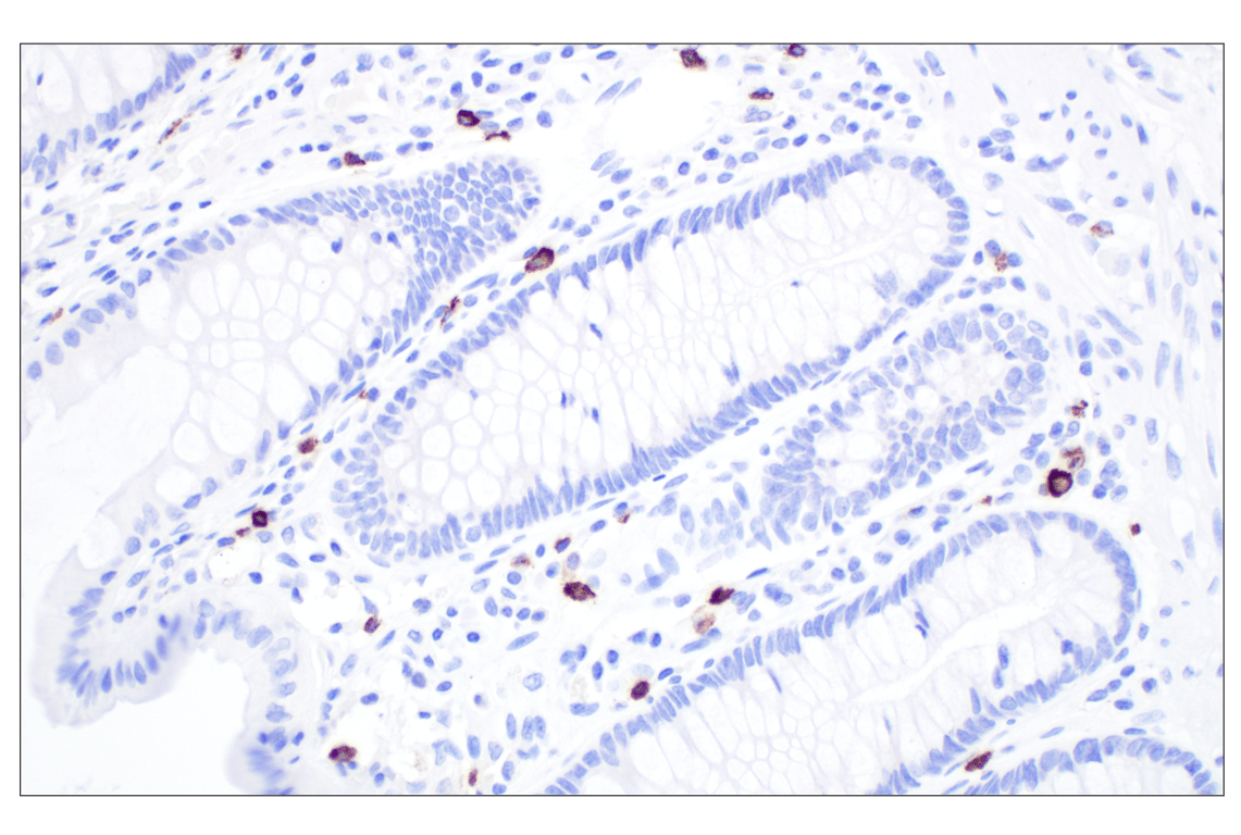 immune ビスチェ An Update on XMEN Disease | Journal of Clinical Immunology