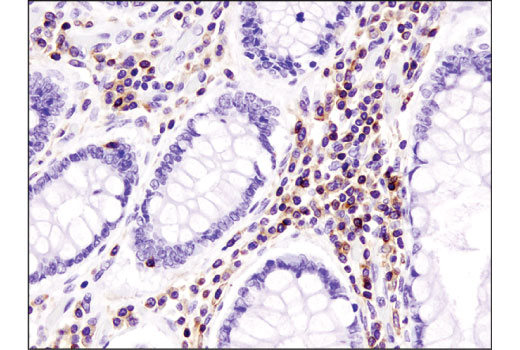 Immunohistochemistry Image 3: CXCR4 (D4Z7W) Rabbit Monoclonal Antibody (BSA and Azide Free)