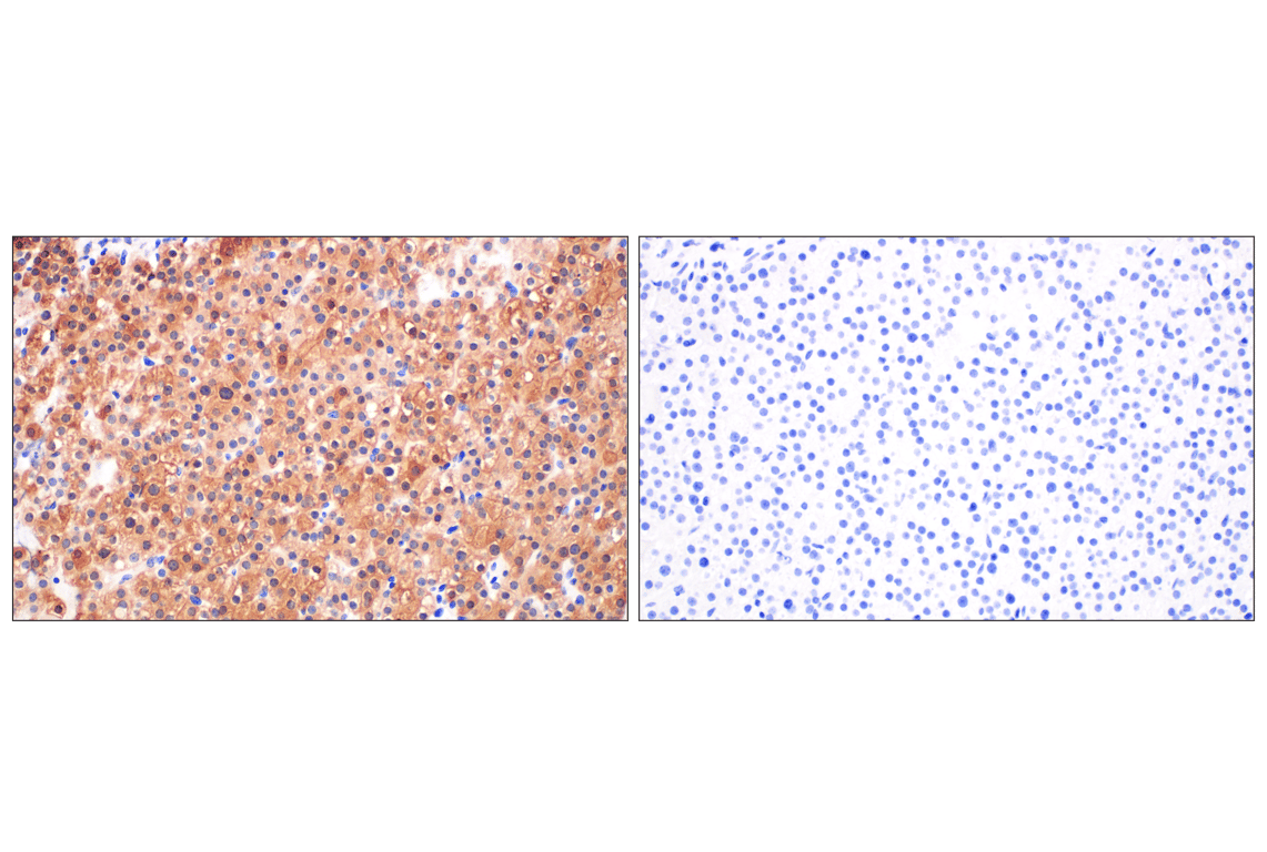 Immunohistochemistry Image 6: cPLA2 (D11H4) Rabbit Monoclonal Antibody
